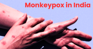 Monkeypox