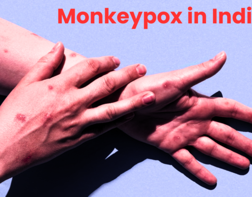 Monkeypox